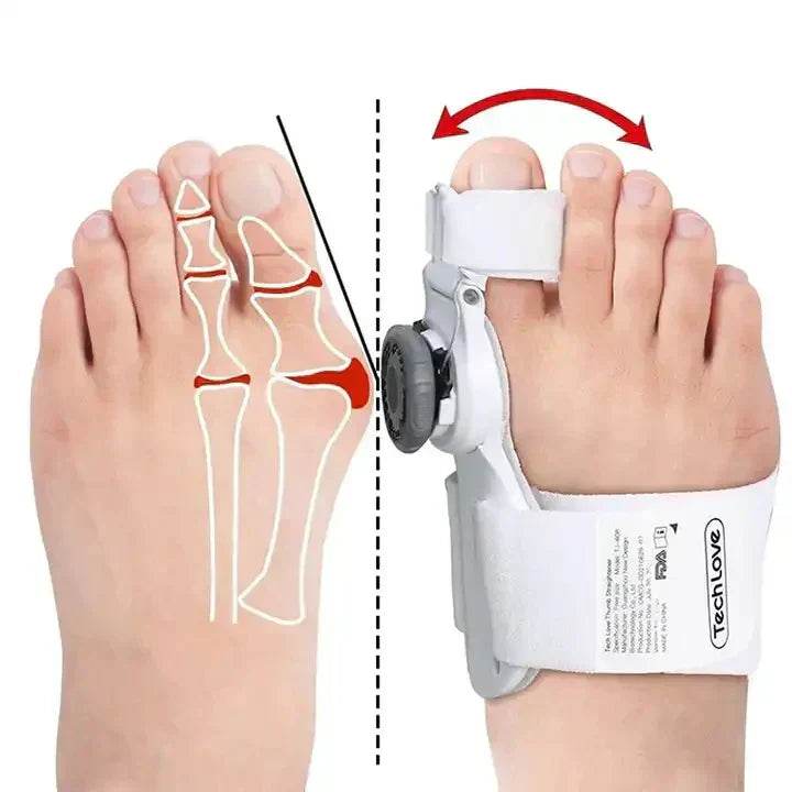 Universal Toe/Bunion Corrector - swmart