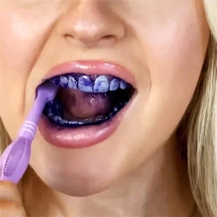 Smilekit Purple Whitening Toothpaste – Transform Your Smile - swmart